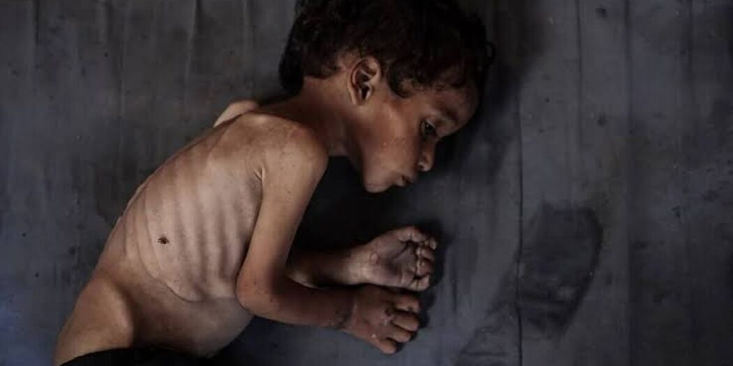 Utanmazlığın zirvesi; Gazzelileri nasıl “obez” ilan ettiler!