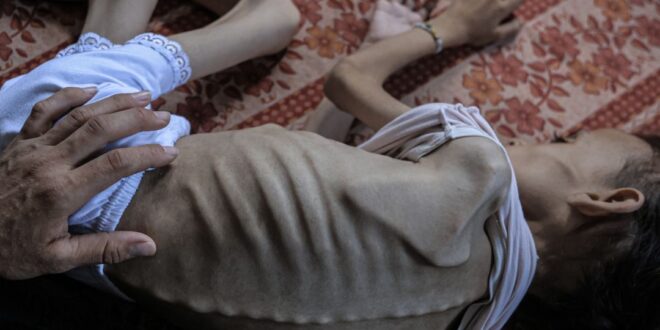 5792029373551986449 121